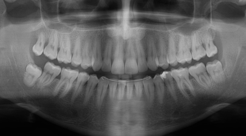 dental-imaging