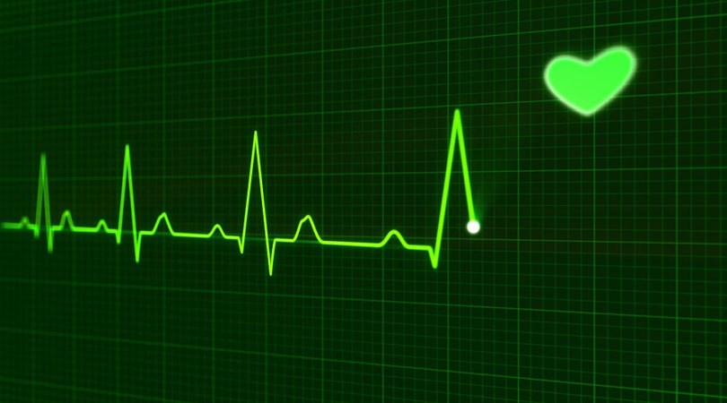 ecg-electrocardiogram